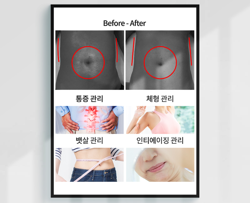 Before/After - 腹部管理事例