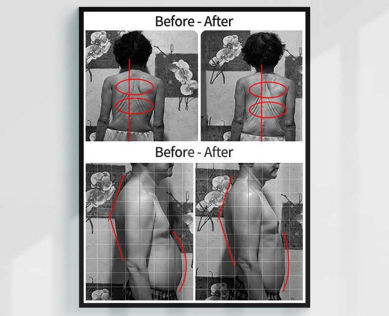 Before/After - 施術結果